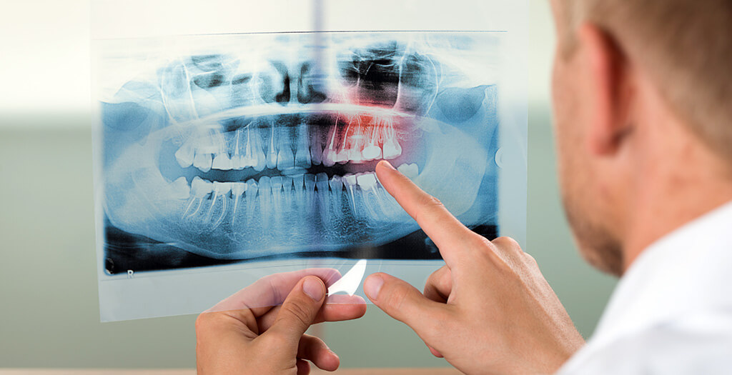 A panoráma röntgen a legnagyobb segítség a fogorvosunknak és nekünk is!