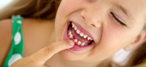 10 dolog, ami a fogak elszíneződéséhez vezethet - Dohányzás okozta fogbetegség